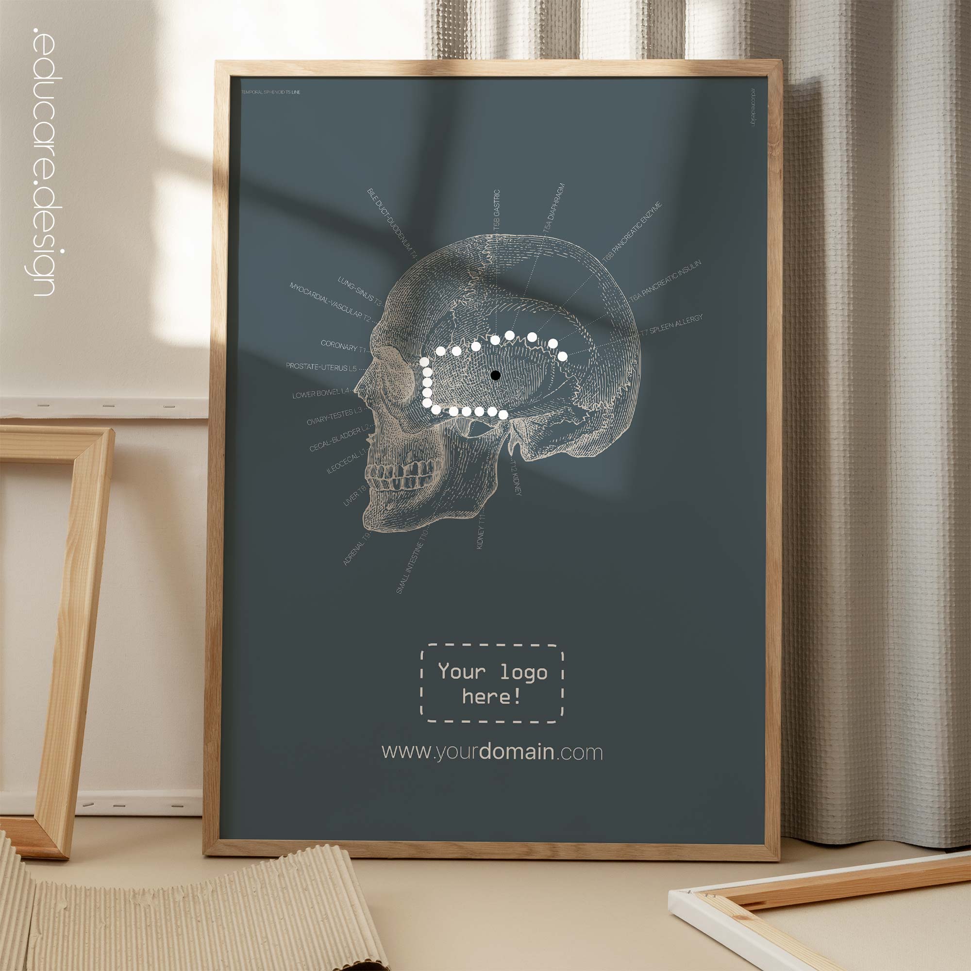 Temporal Sphenoid Line