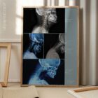 Vorwärts gerichtete Kopfhaltung