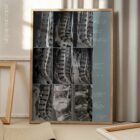 Lumbar Pathology anatomy chart for clinics