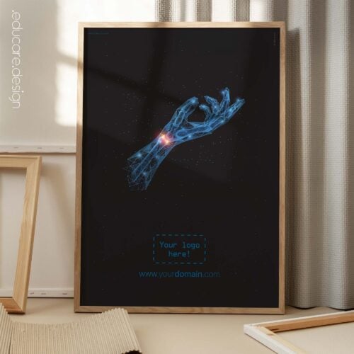 Sindrome del tunnel carpale