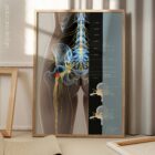 Sciatica and stenosis artwork from educare.design