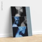 Vorwärts gerichtete Kopfhaltung