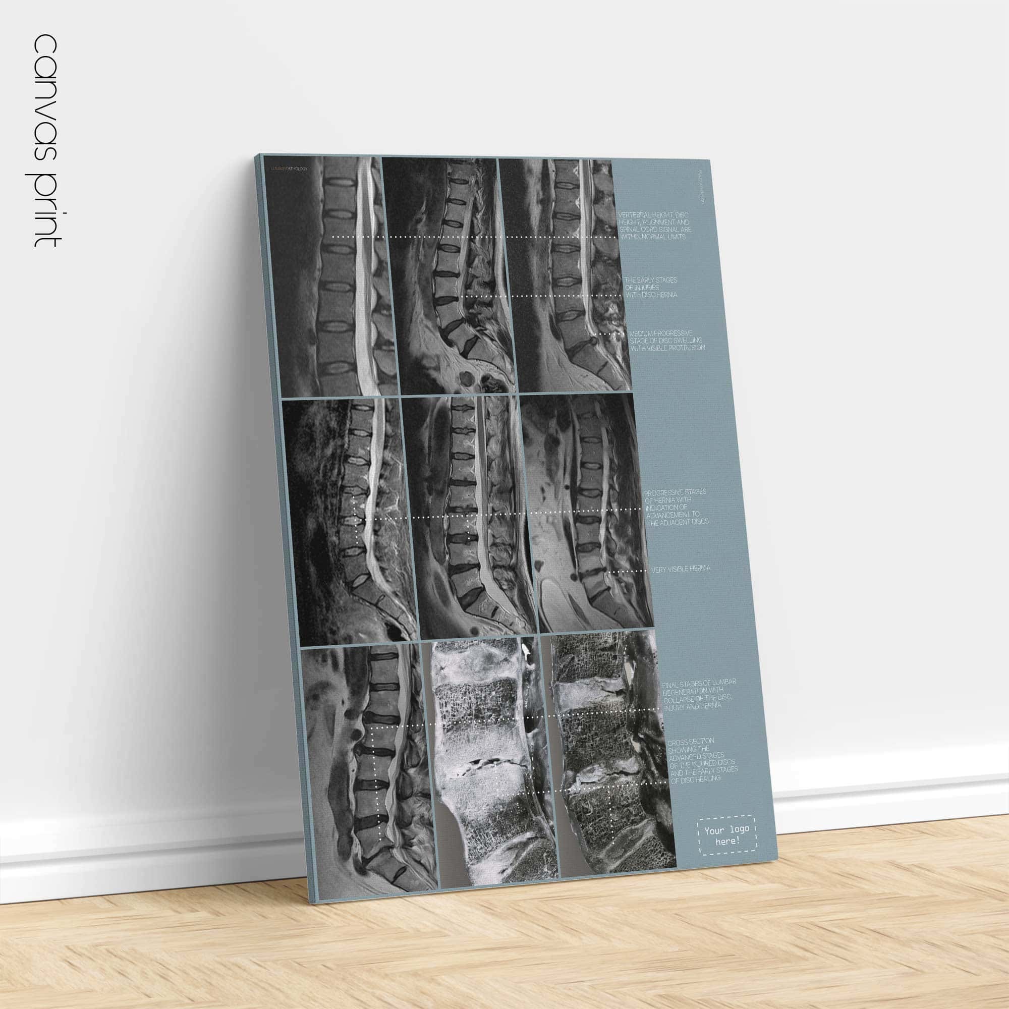 Obra de patología lumbar de educare.design