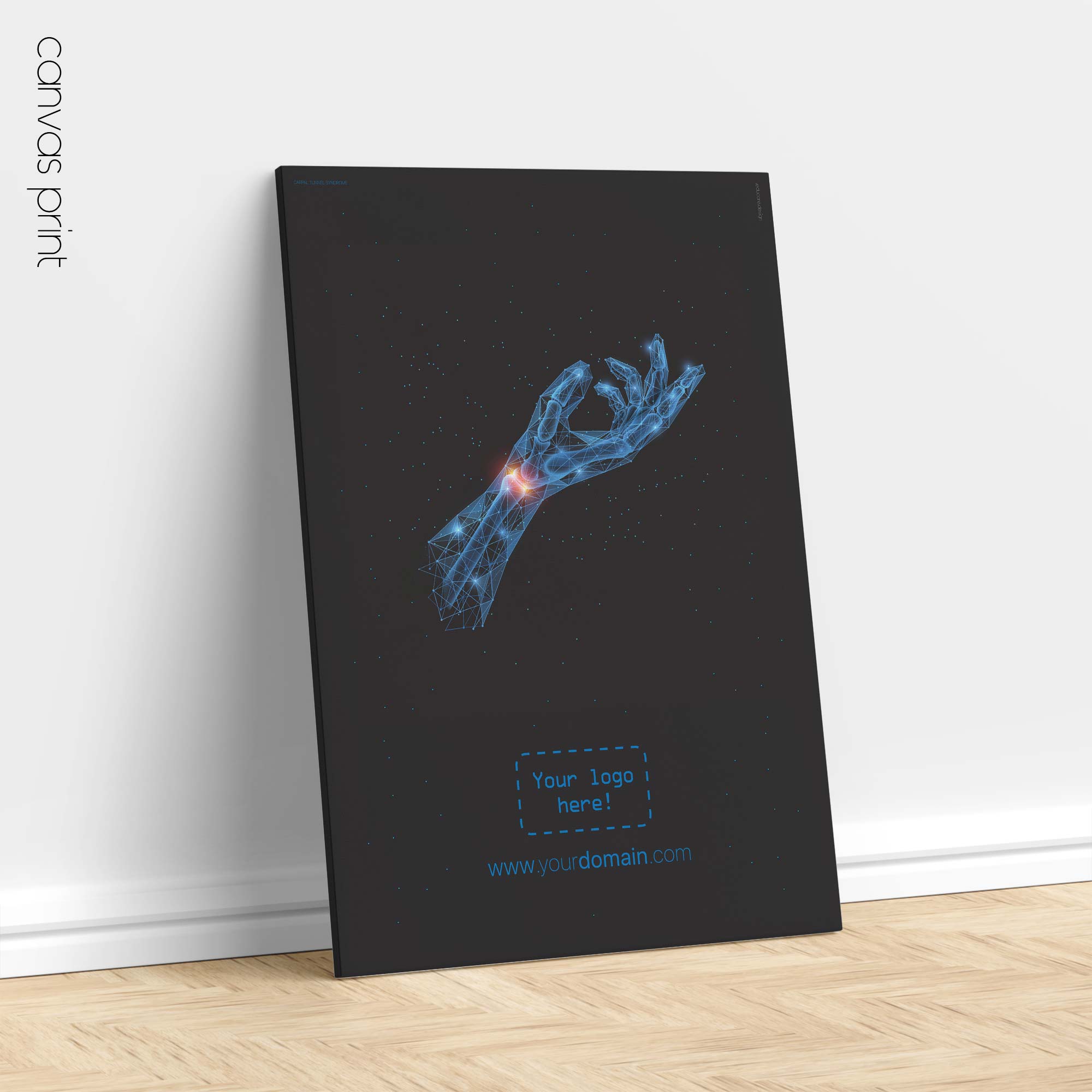 Sindrome del tunnel carpale