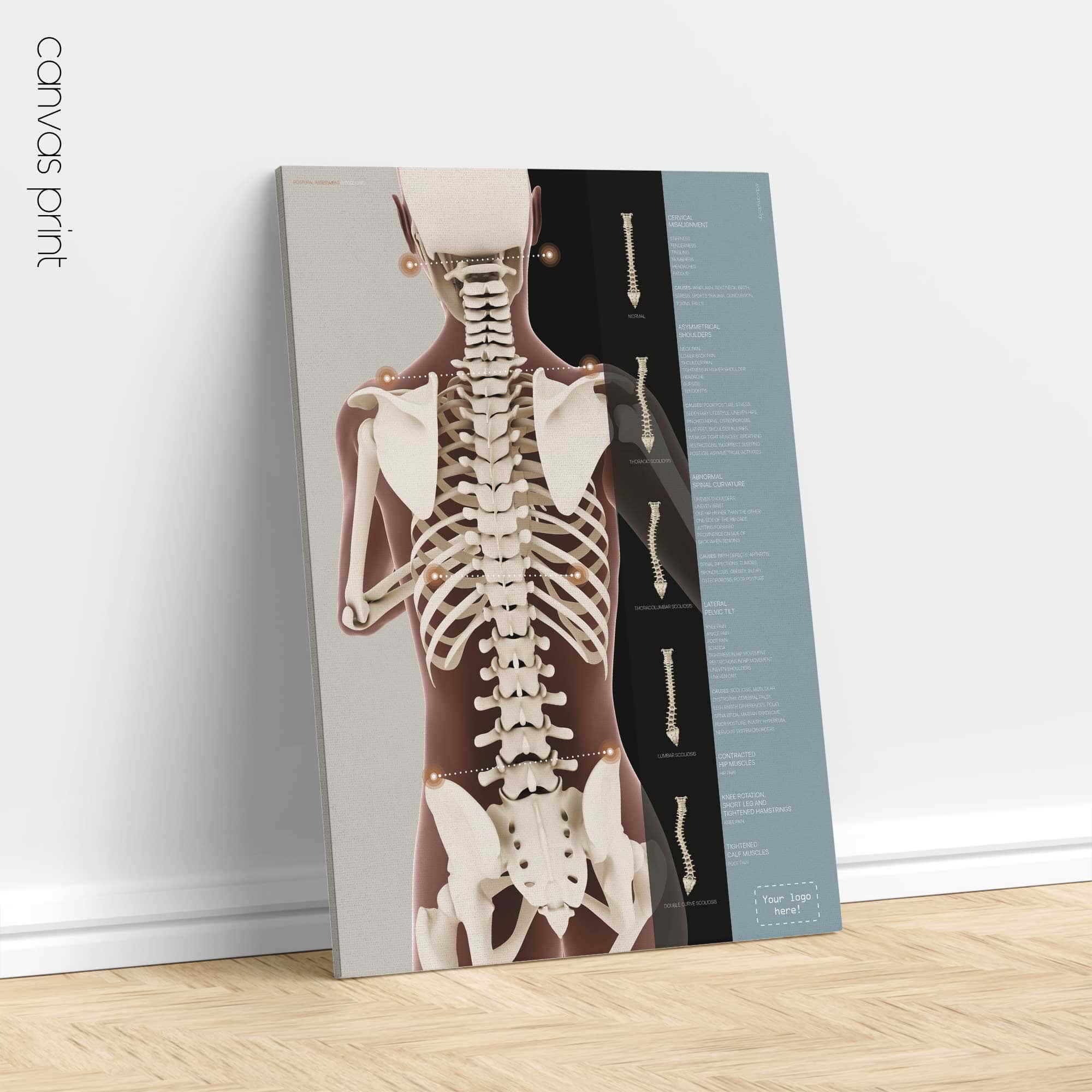 Postural Assessment and Scoliosis. Anatomy and physiology artwork from educare.design