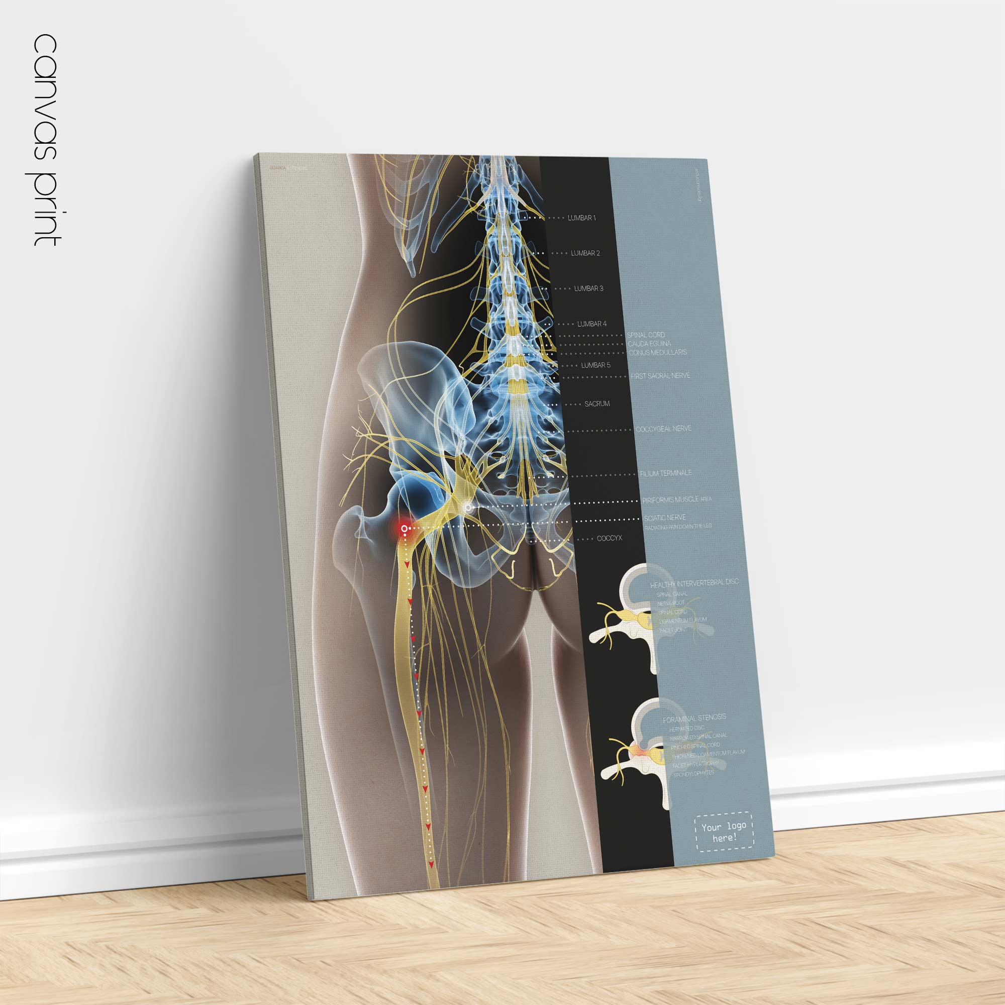 Sciatica and stenosis artwork from educare.design