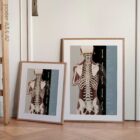 Postural Assessment and Scoliosis anatomy chart for clinics