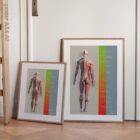 Treatment Plan (Road-to-Recovery) anatomy chart for clinics