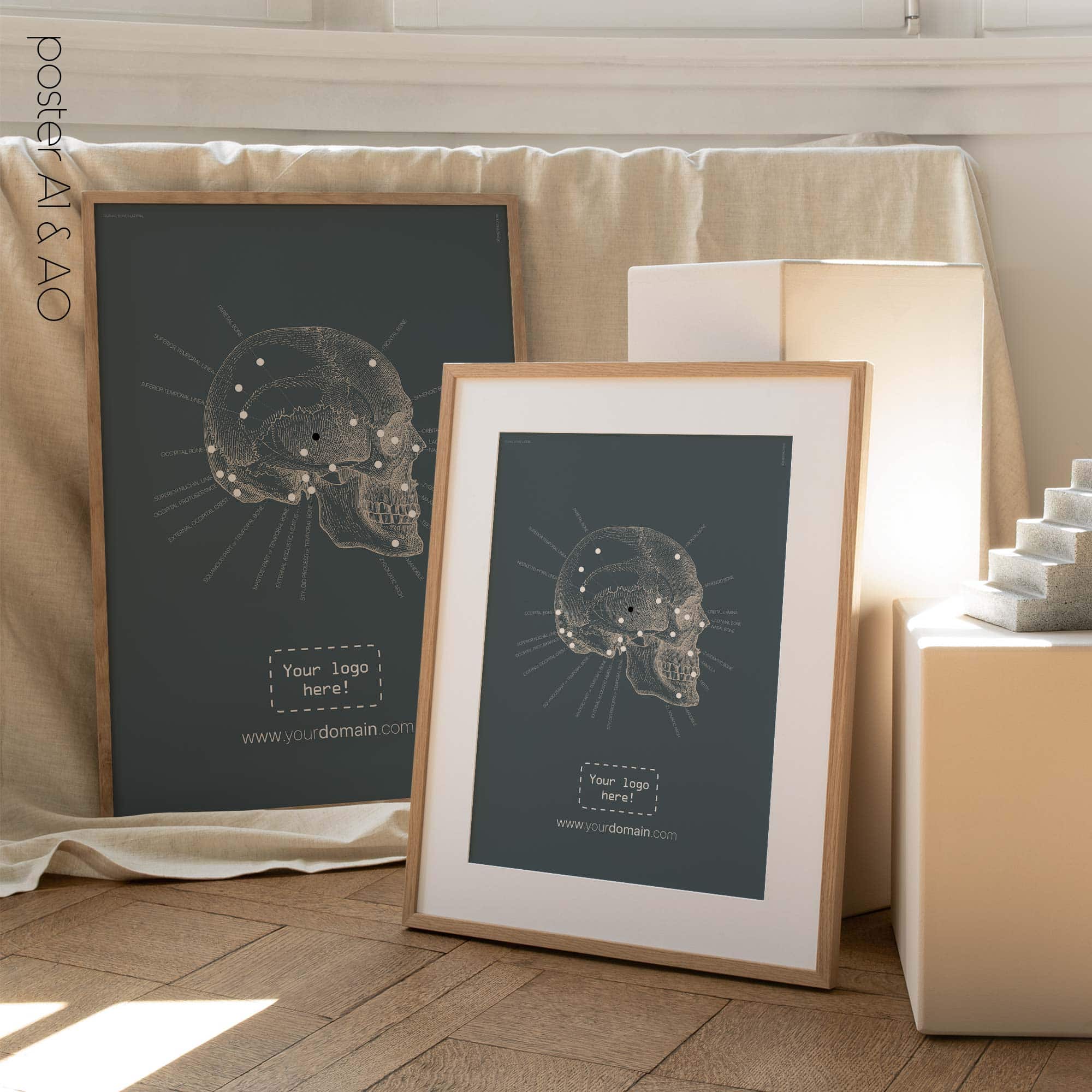 Lateral Cranial Bones