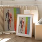 Treatment Plan (Road-to-Recovery) anatomy chart for clinics