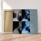 Vorwärts gerichtete Kopfhaltung