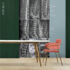 Lumbar Pathology anatomy chart for clinics
