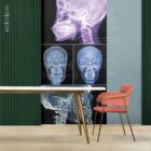 TMJ Disorder anatomy chart for clinics
