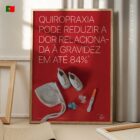 ChiroStat (5) Dor Relacionada com a Gravidez diagrama anatómico para clínicas e consultórios