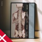 Holdningsanalyse & Skoliose anatomidiagram til klinikker