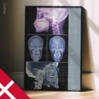 TMJ-Lidelse anatomidiagram til klinikker