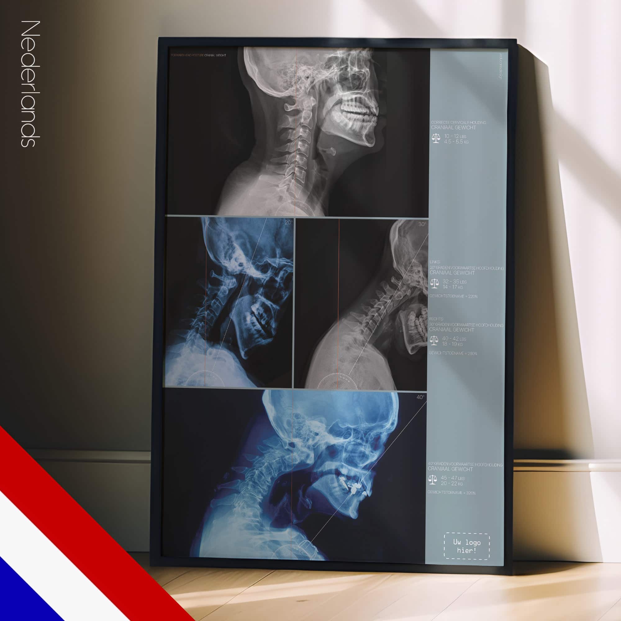 Voorwaartse Hoofdhouding