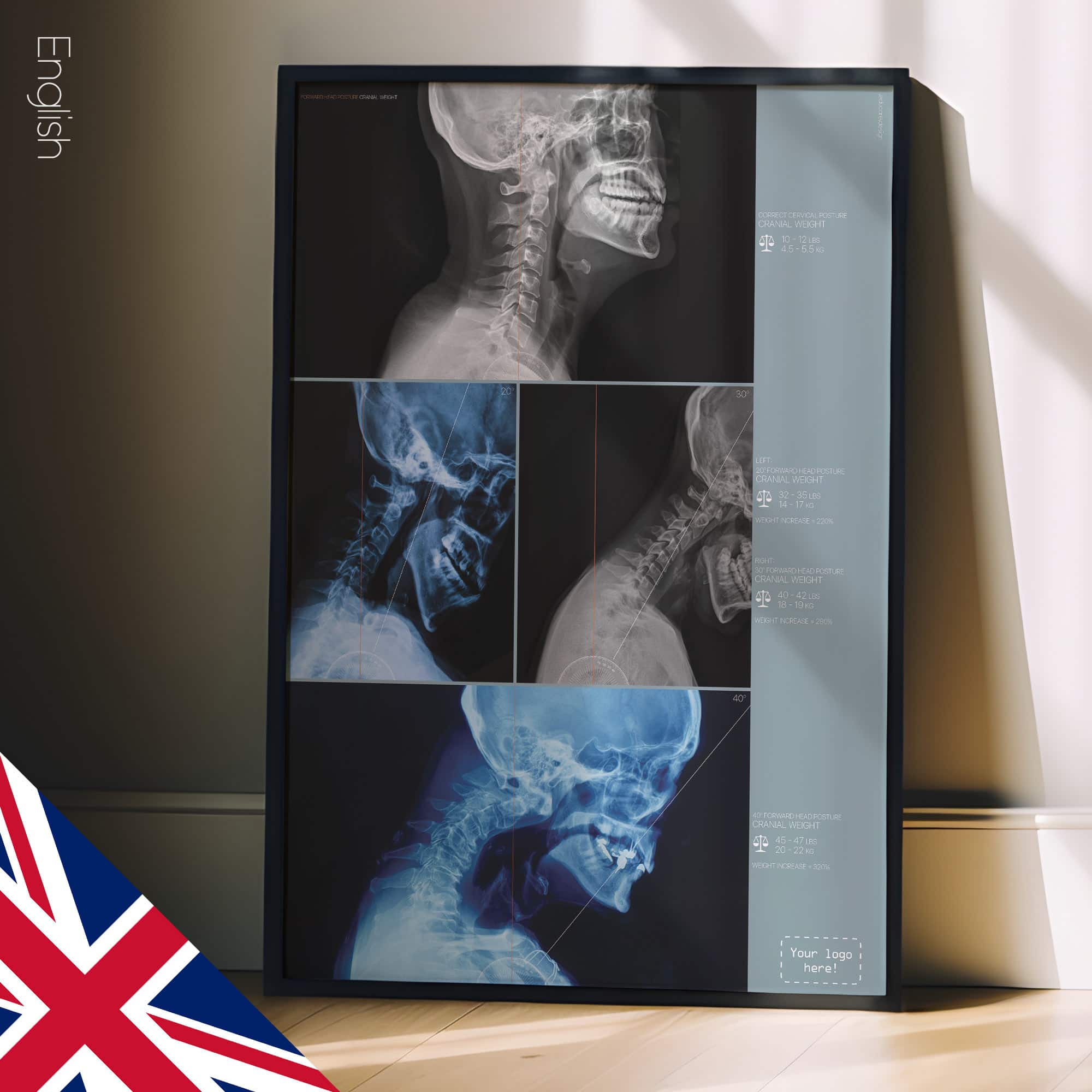 Vorwärts gerichtete Kopfhaltung