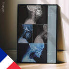 Vorwärts gerichtete Kopfhaltung