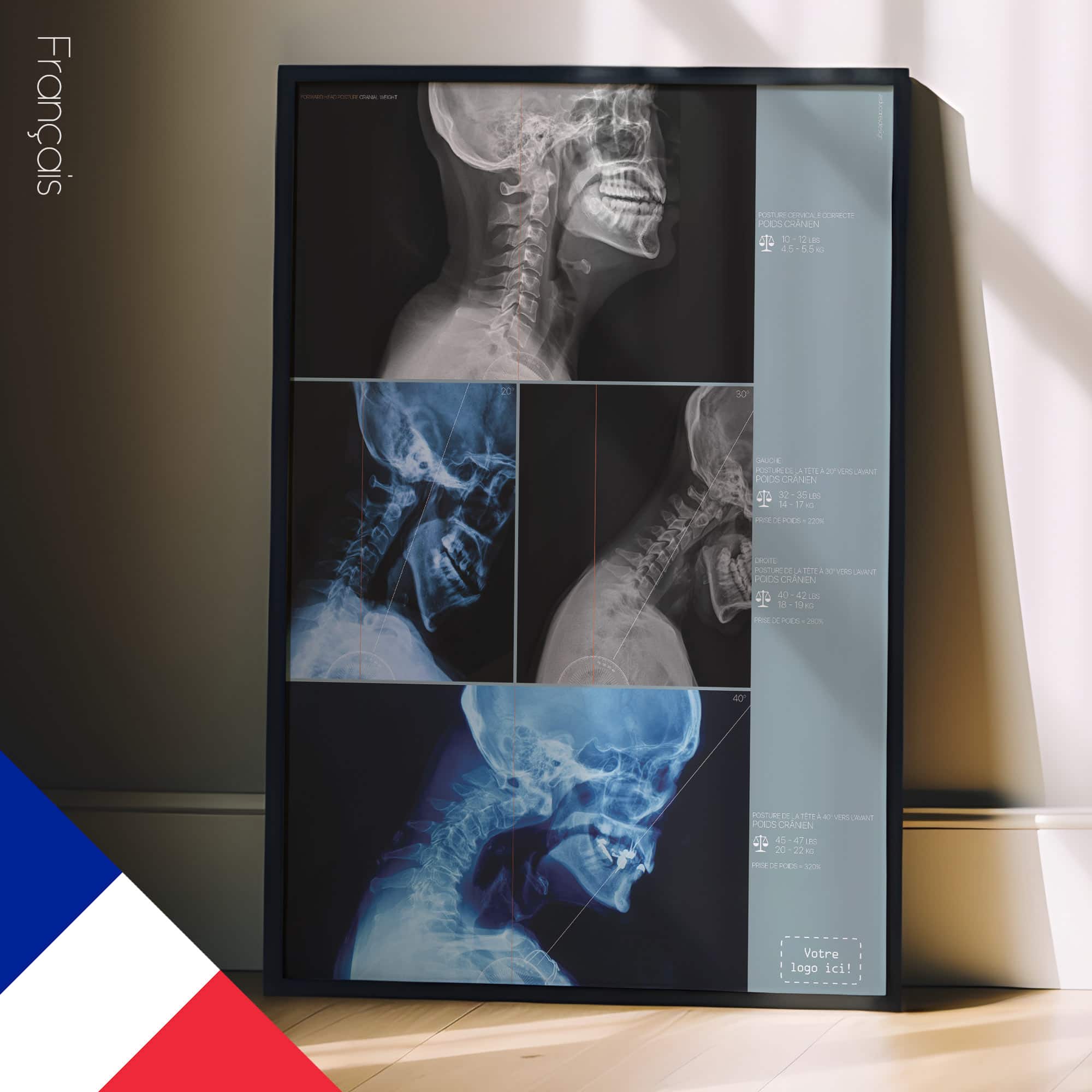 Vorwärts gerichtete Kopfhaltung