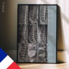 Pathologie Lombaire planche anatomique pour cabinets et cliniques