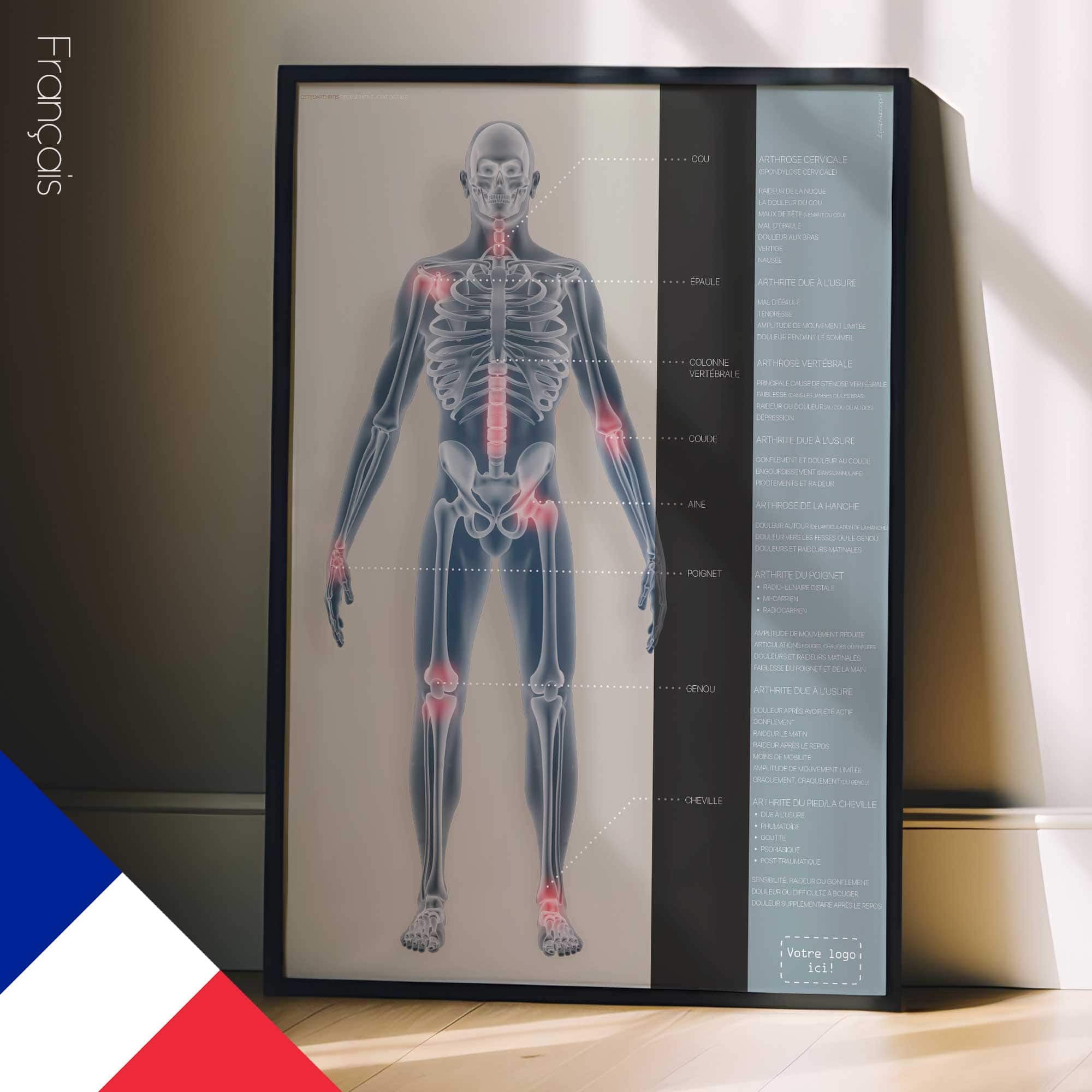 Arthrose. Dessin d'anatomie et de physiologie d'educare.design