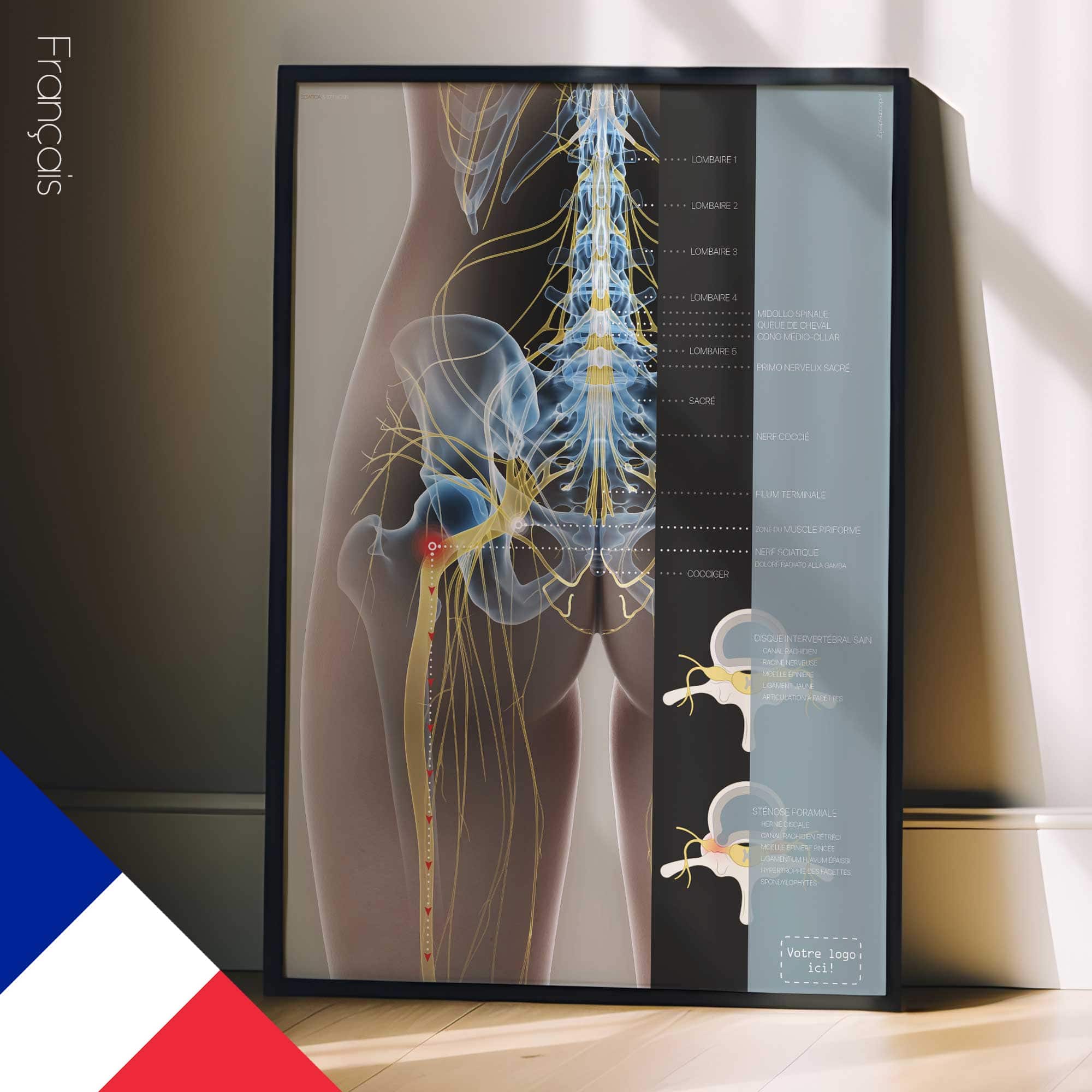 Sciatica and stenosis artwork from educare.design