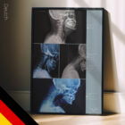 Kopfhaltung nach vorne und Schädelgewicht