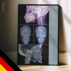 Kiefergelenksdysfunktion (TMJ Disorder) Anatomie-Chart für Praxen und Kliniken