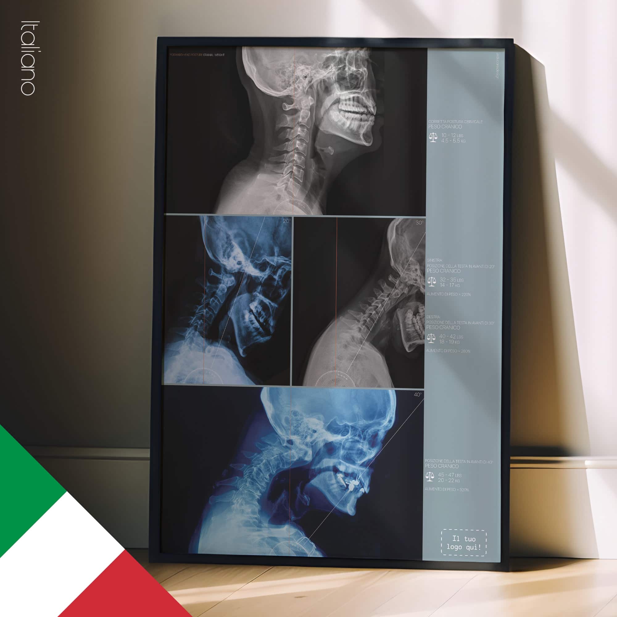 Postura della Testa in Avanti e del Peso Craniale