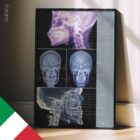 Disturbo dell’Articolazione Temporo-Mandibolare (ATM) tavola anatomica per studi e cliniche