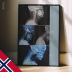 Vorwärts gerichtete Kopfhaltung