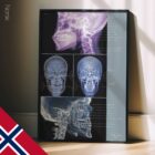 TMJ-Lidelse anatomidiagram for klinikker