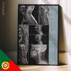 Patologia Cervical diagrama anatómico para clínicas e consultórios