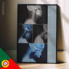 Vorwärts gerichtete Kopfhaltung