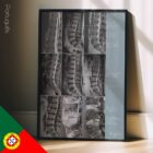 Patologia Lombar diagrama anatómico para clínicas e consultórios