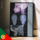 Disfunção da ATM diagrama anatómico para clínicas e consultórios