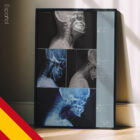 Postura de la Cabeza Adelantada y Peso Craneal