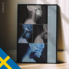 Vorwärts gerichtete Kopfhaltung