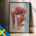 Anatomidiagram över Vanliga Muskuloskeletala Skador och Besvär anatomidiagram för kliniker