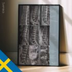 Lumbal Patologi anatomidiagram för kliniker