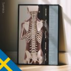 Hållningsanalys & Skolios anatomidiagram för kliniker