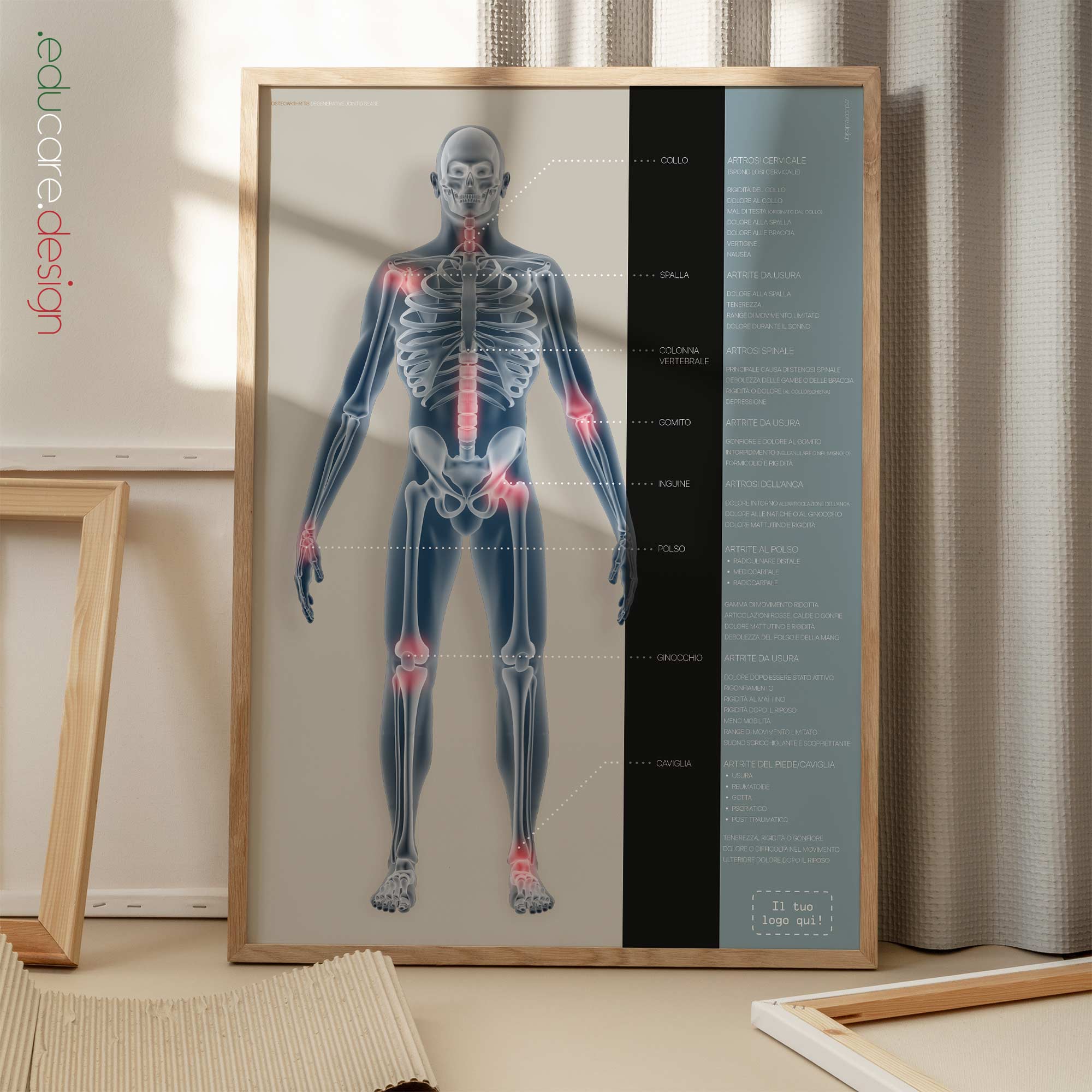 Osteoarthritis. Anatomy and physiology artwork from educare.design