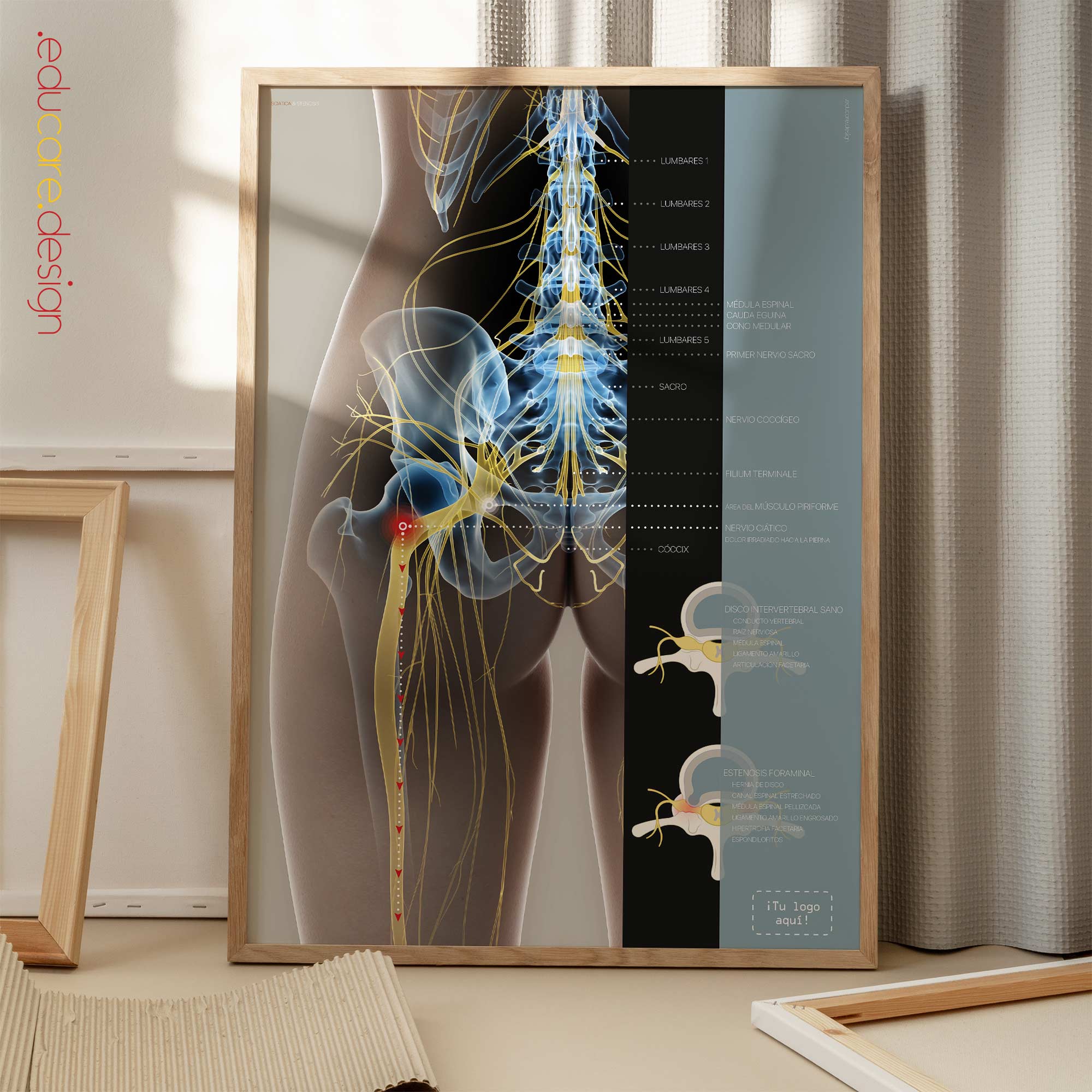 Sciatica and stenosis artwork from educare.design