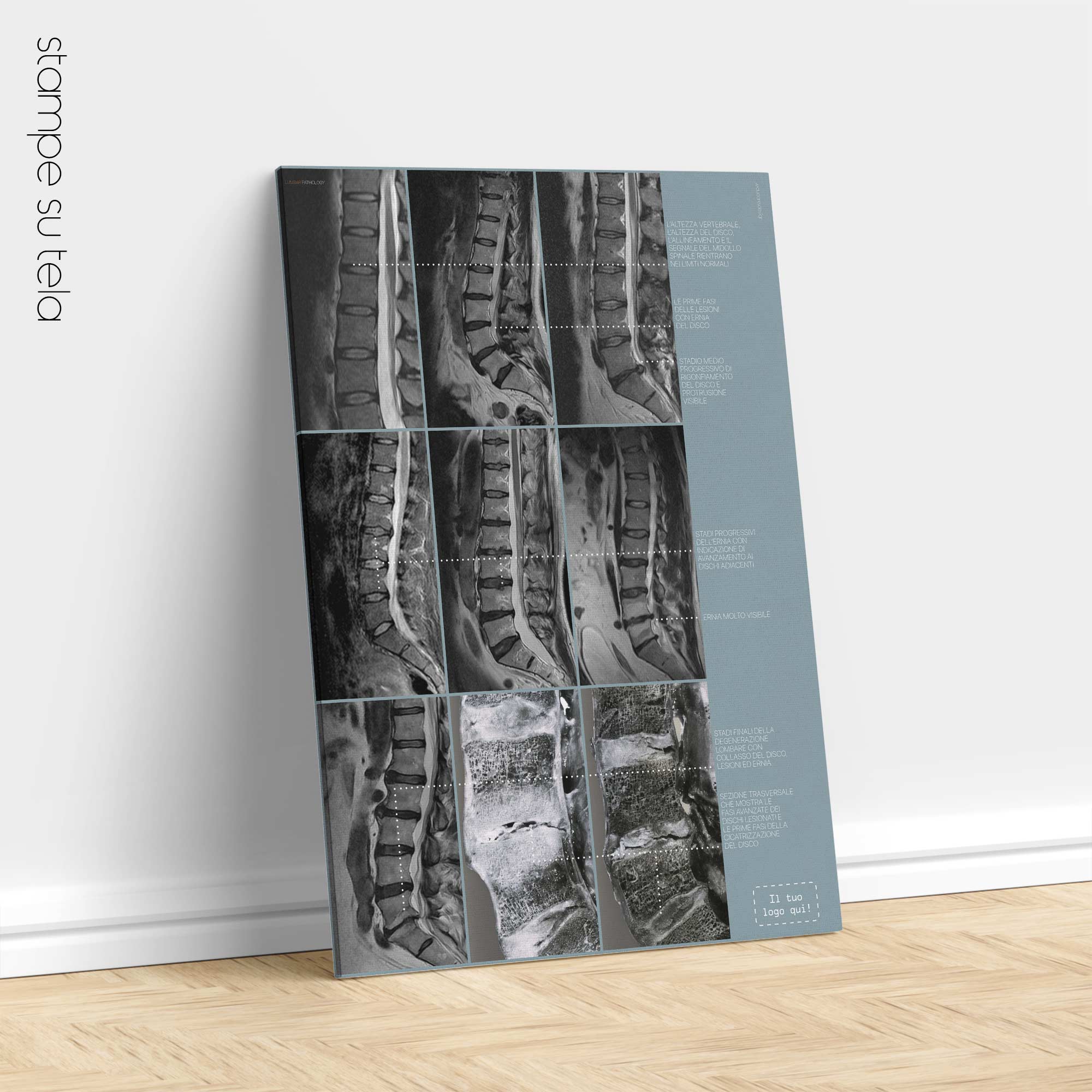 Lumbar Pathology artwork from educare.design