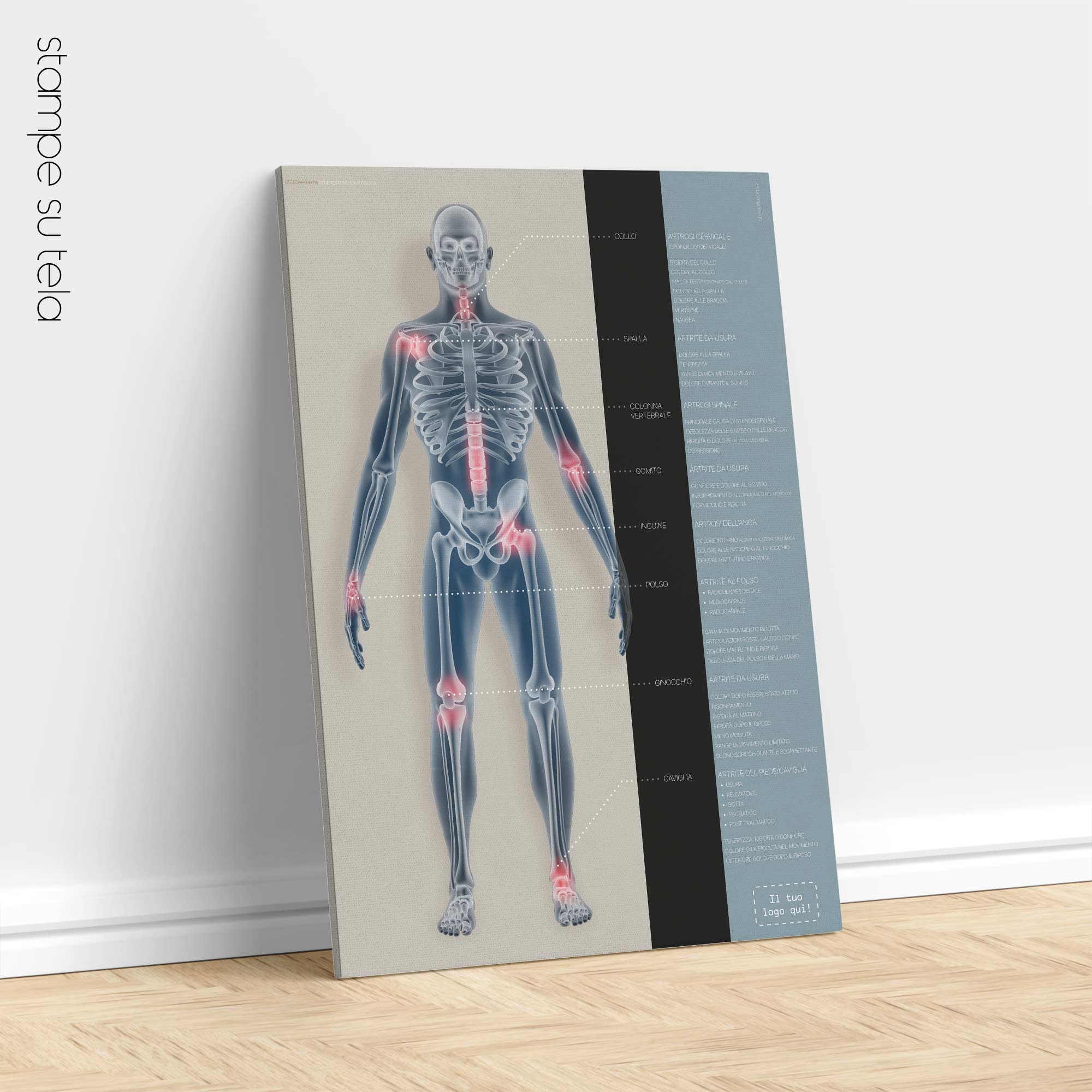 Osteoarthritis. Anatomy and physiology artwork from educare.design