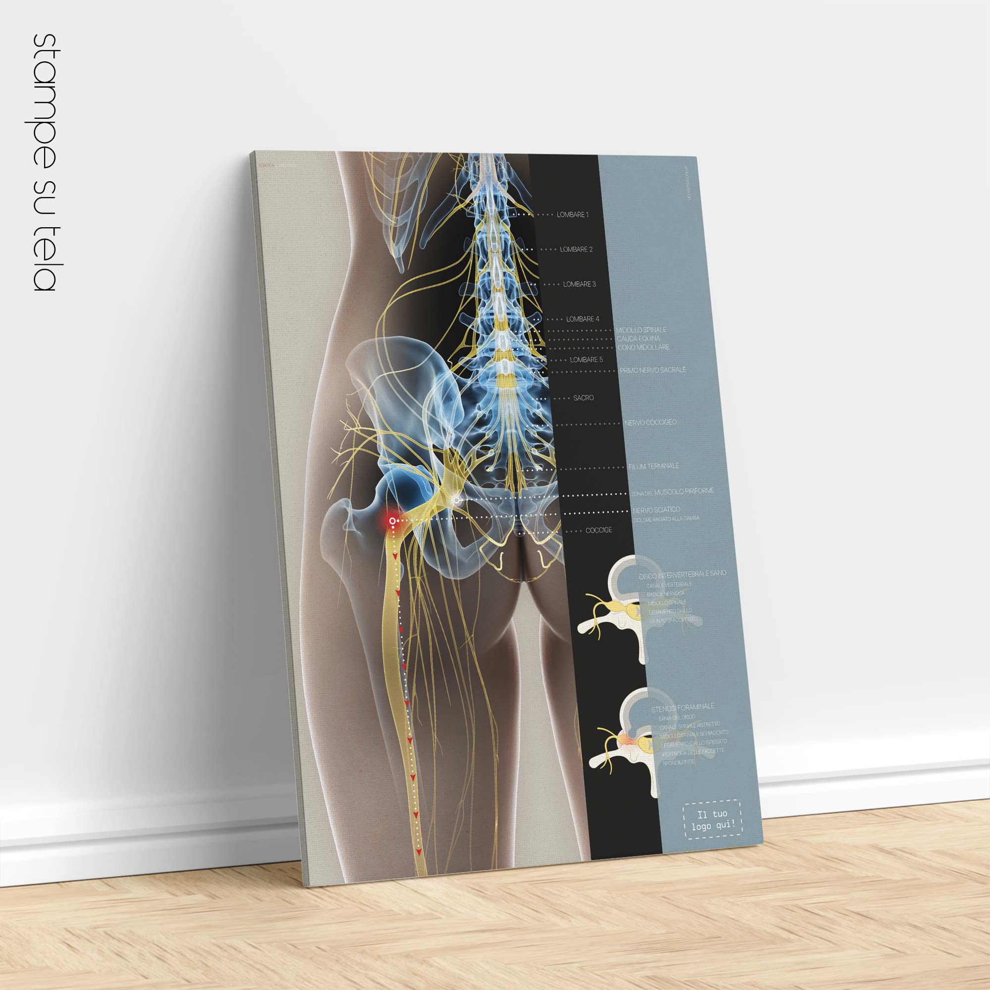 Sciatica and stenosis artwork from educare.design