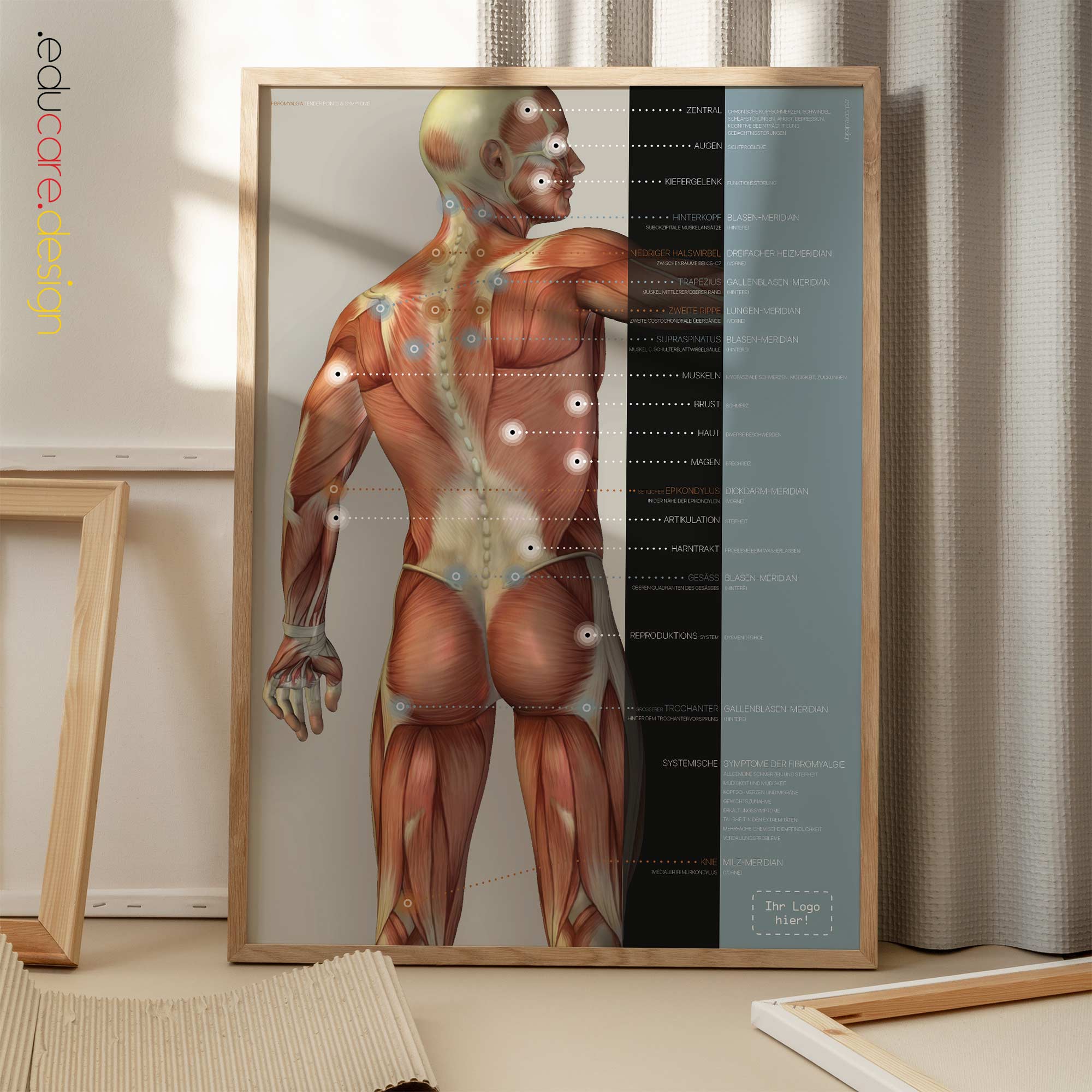 Fibromyalgia; Tender Points & Symptoms. Anatomy and physiology artwork from educare.design