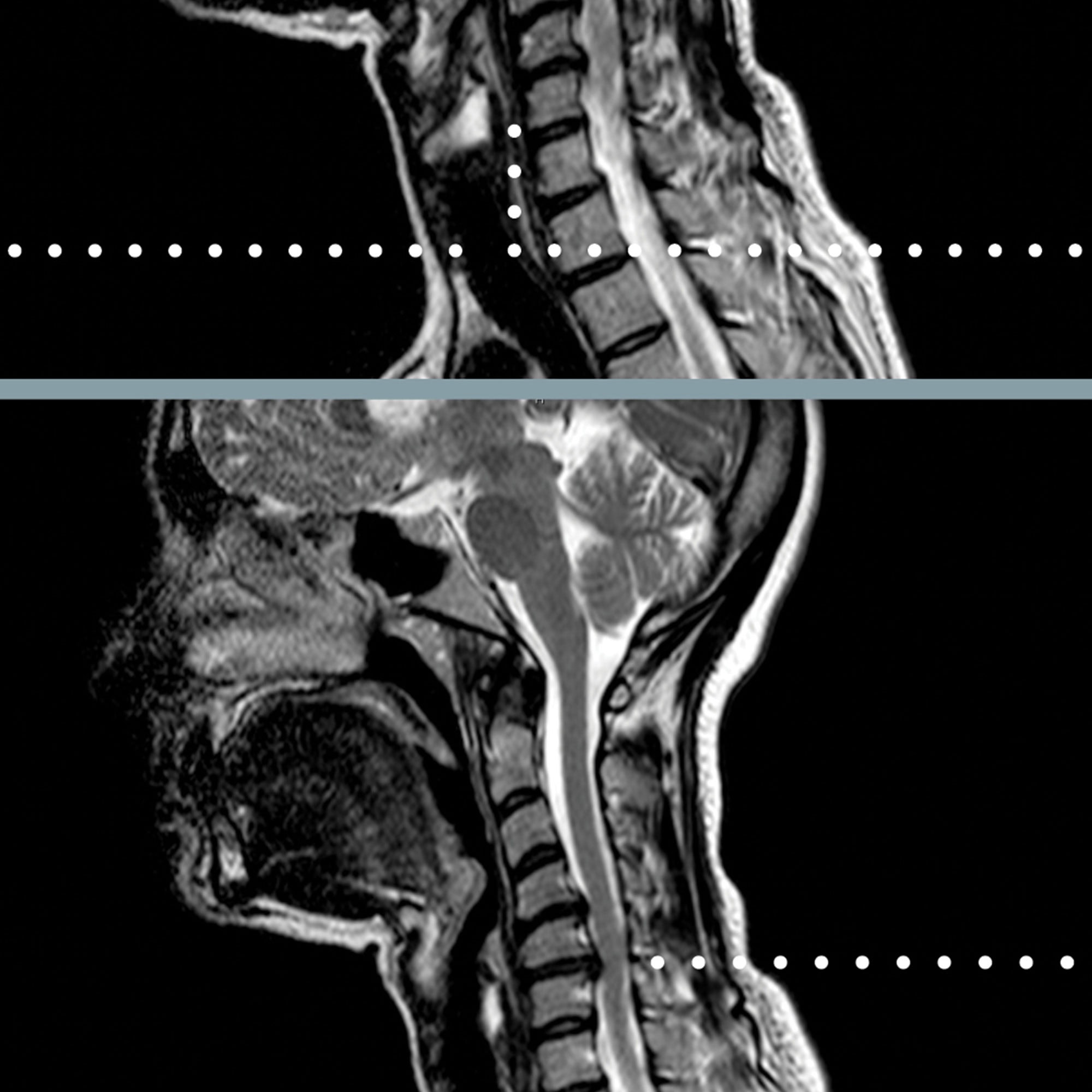 cervical pathology italian zoom 2