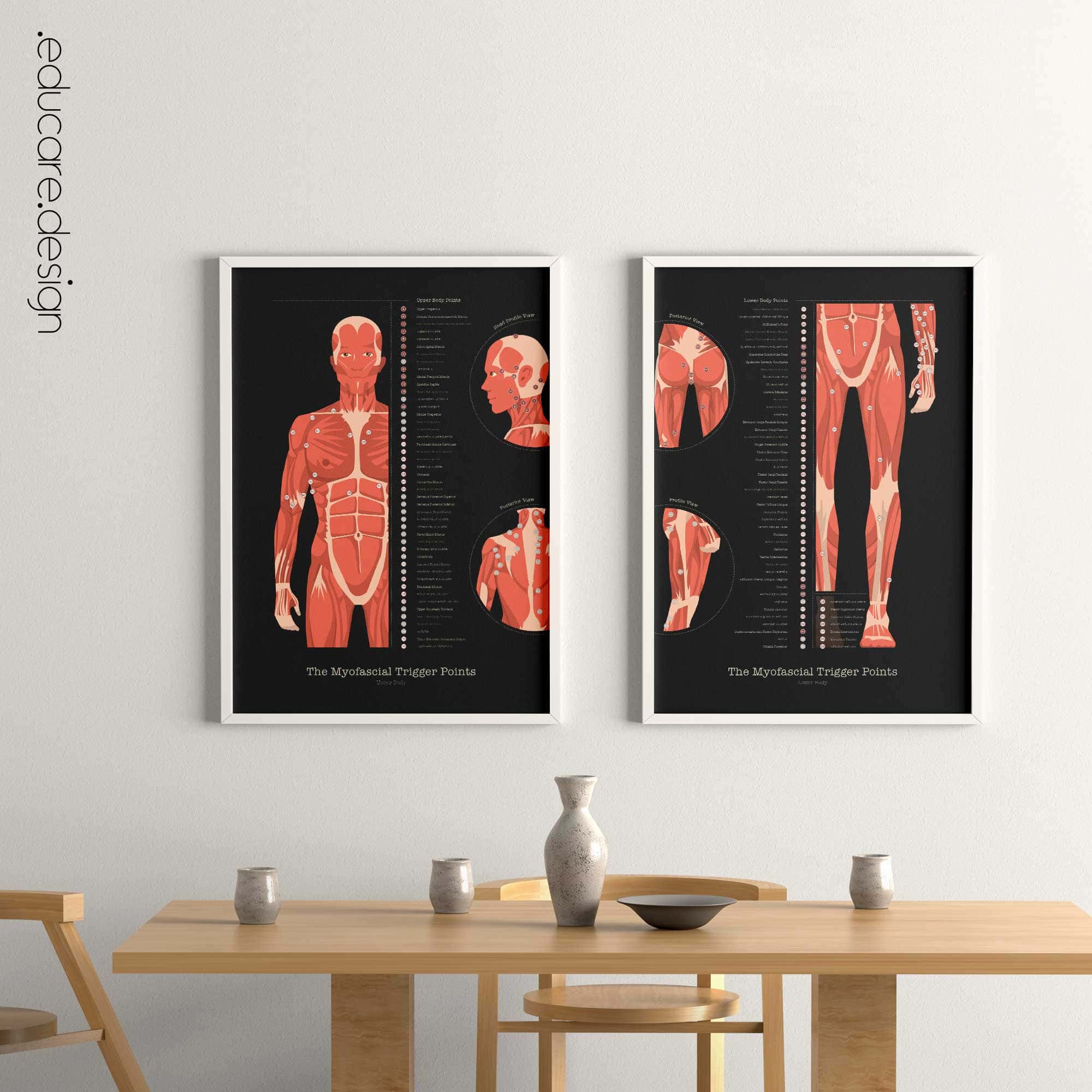 Myofascial Trigger Points Anatomy Chart, Black Edition